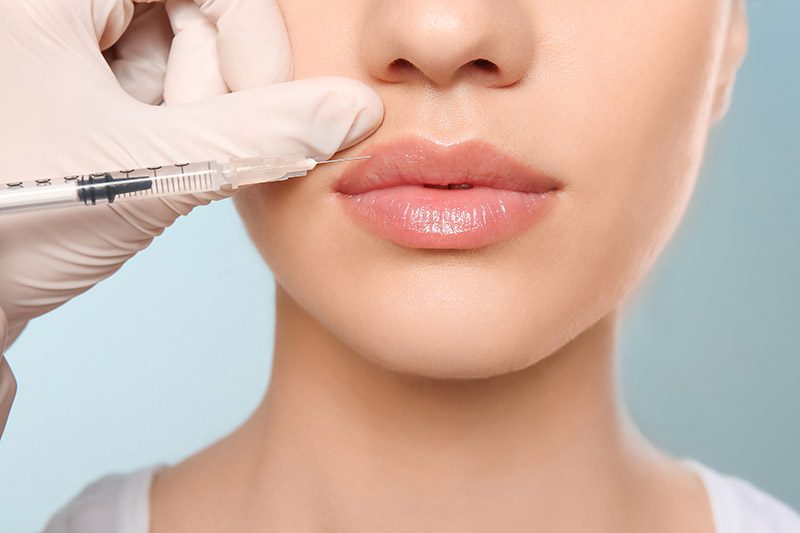 Derma Fillers in Pacifica