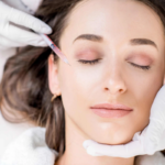 Woman receiving a non-invasive wrinkle treatment with Botox in Pacifica, CA to smooth fine lines and facial wrinkles.